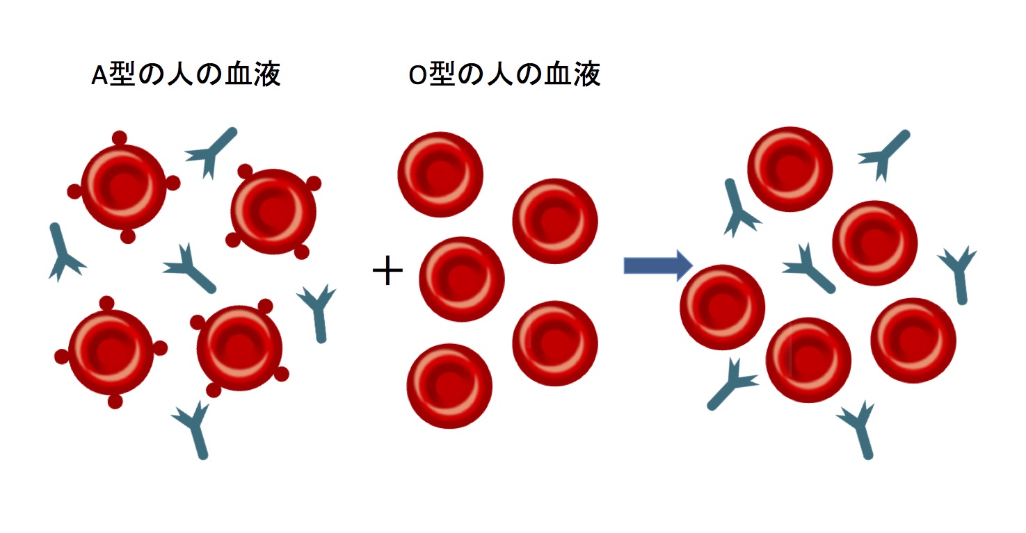 輸血ではo型が不利 Abo式血液型を徹底解説 Ken S Note